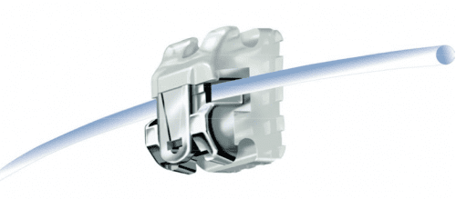 Bracket autoligable estético Damon