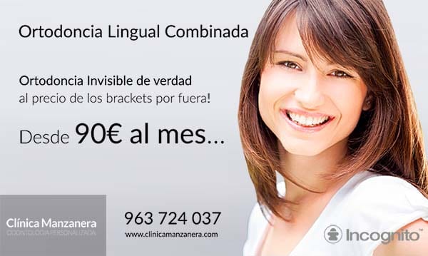 ortodoncia lingual combinada