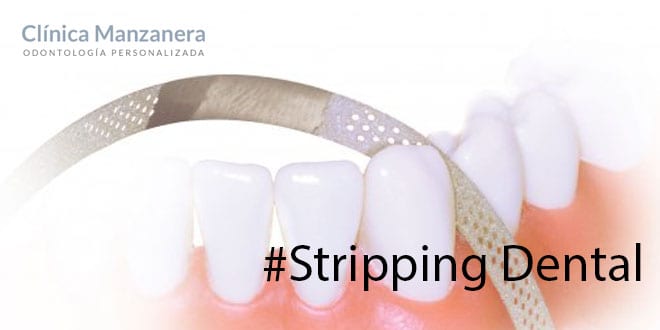 limar dientes stripping