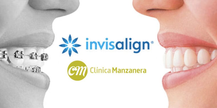 invisalign precio