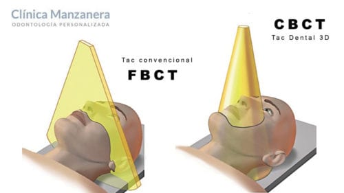 cbct tac dental 3d