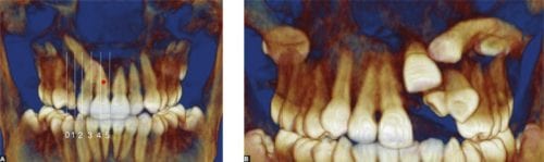 radiografia dental 3d