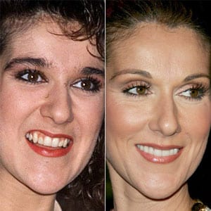 celine dion dientes y sonrisa