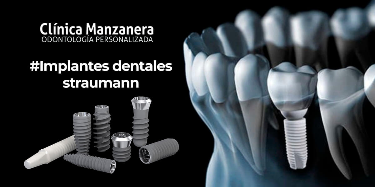 implantes dentales straunman