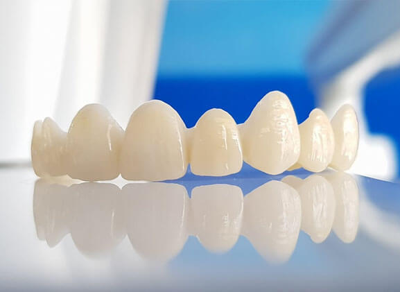 Dental Elizondo - Corona de porcela. Corona metal blanco