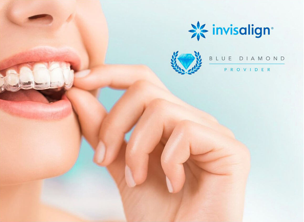 invisalign diamond provider valencia