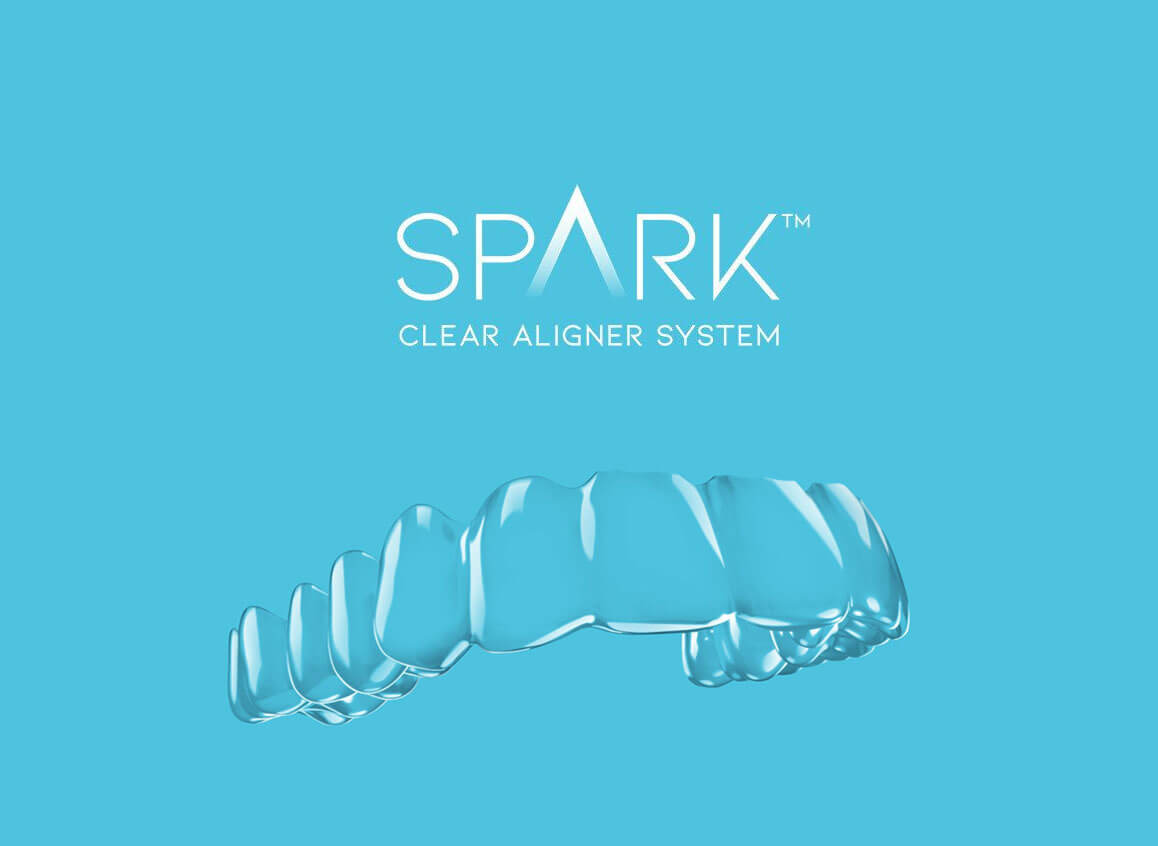 spark aligners valencia